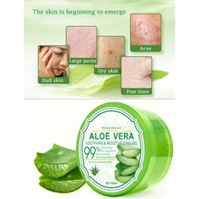 Charger l&#39;image dans la galerie, ALOE VERA علاج حب الشباب
